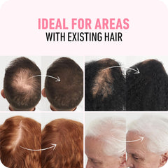 Boldify before-and-after part comparison showing concealed thinning and realistic result