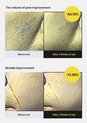 celimax aplicación nocturna del serum en mejilla para mejorar textura