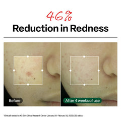 Dr.G crema aplicada en manos para mostrar fácil extensión y confort