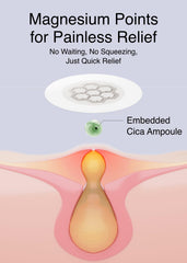 DWEasyDerm ampolla de cica con gota mínima, calma puntual visible