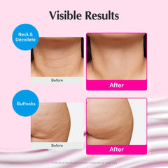 EQQUALBERRY demo de aplicación en cuello mostrando elevación y firmeza