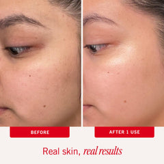 First Aid Beauty frasco y representación del ácido glicólico activo