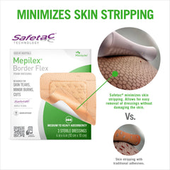 Mepilex detalle del borde Flex que mejora la adaptación al cuerpo