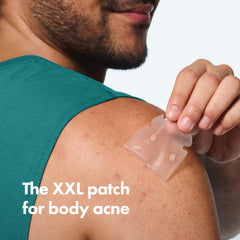 Mighty Patch parche desplegado mostrando formato XXL y protección