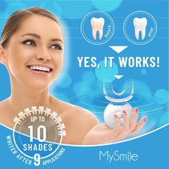 MySmile jeringa con gel 3% carbamida en primer plano para aplicación precisa