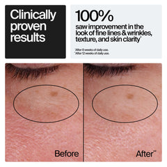 Neutrogena detalle de etiqueta con información de retinol y beneficios claros
