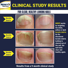 Persona aplicando NONYX en uñas de los pies, producto fácil y rápido