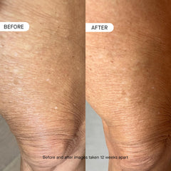 oneskin frasco junto a objetos para escala, beneficio claridad de tamaño