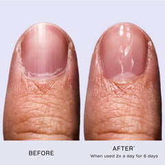 OPI comparación de tamaño junto a monedas para escala, beneficio fácil transporte