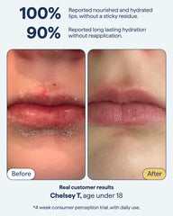 Remedy Science aplicación en labios para reparación y sellado
