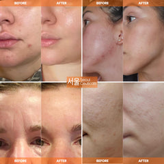 SeoulCeuticals primer plano de la crema que muestra su consistencia nutritiva