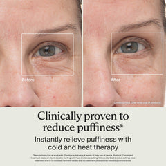 TheraFace aplicando en contorno de ojos para reducir bolsas y mejorar mirada
