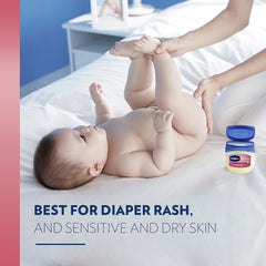 Vaseline aplicada en piel de bebé para protección y suavidad