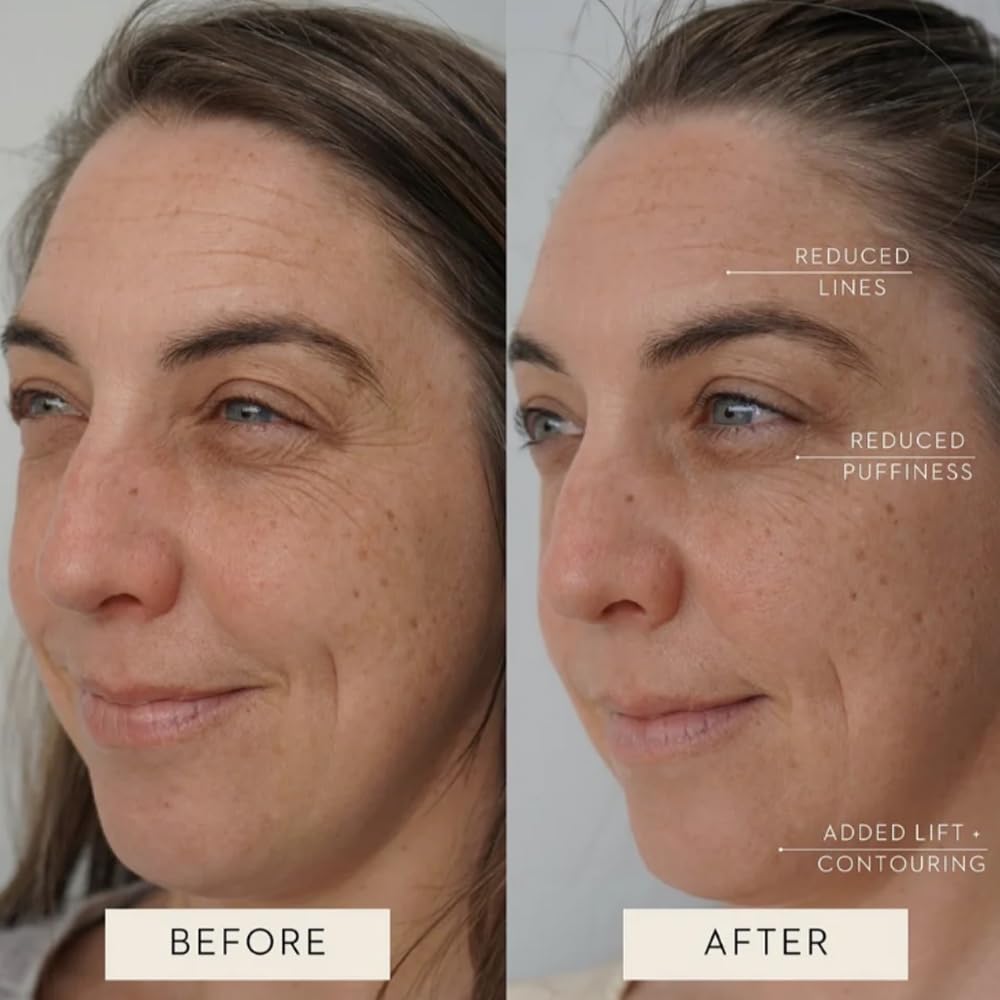 Aeki aplicando serum y potenciando absorción del producto