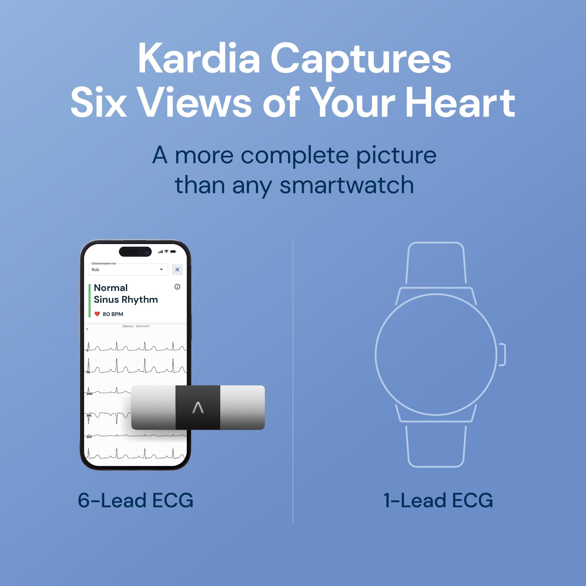 AliveCor KardiaMobile 6L Max comparación de tamaño con teléfono para escala visual