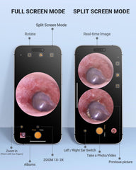 AnyScope punta espátula de silicona segura y suave para manipulación controlada
