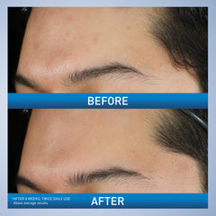 CeraVe textura cremosa transformándose en espuma para limpieza efectiva y suave