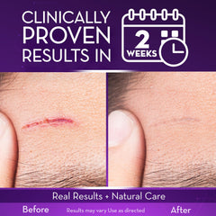 Cicatricure gel texture swatch demonstrating lightweight, non-greasy absorption