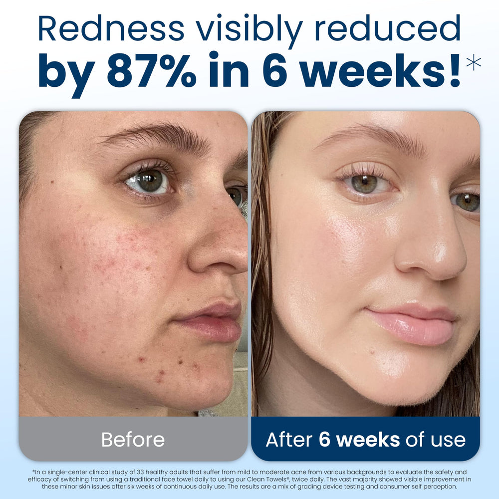 Clean Skin Club toalla desplegada tamaño XL, gran cobertura práctica