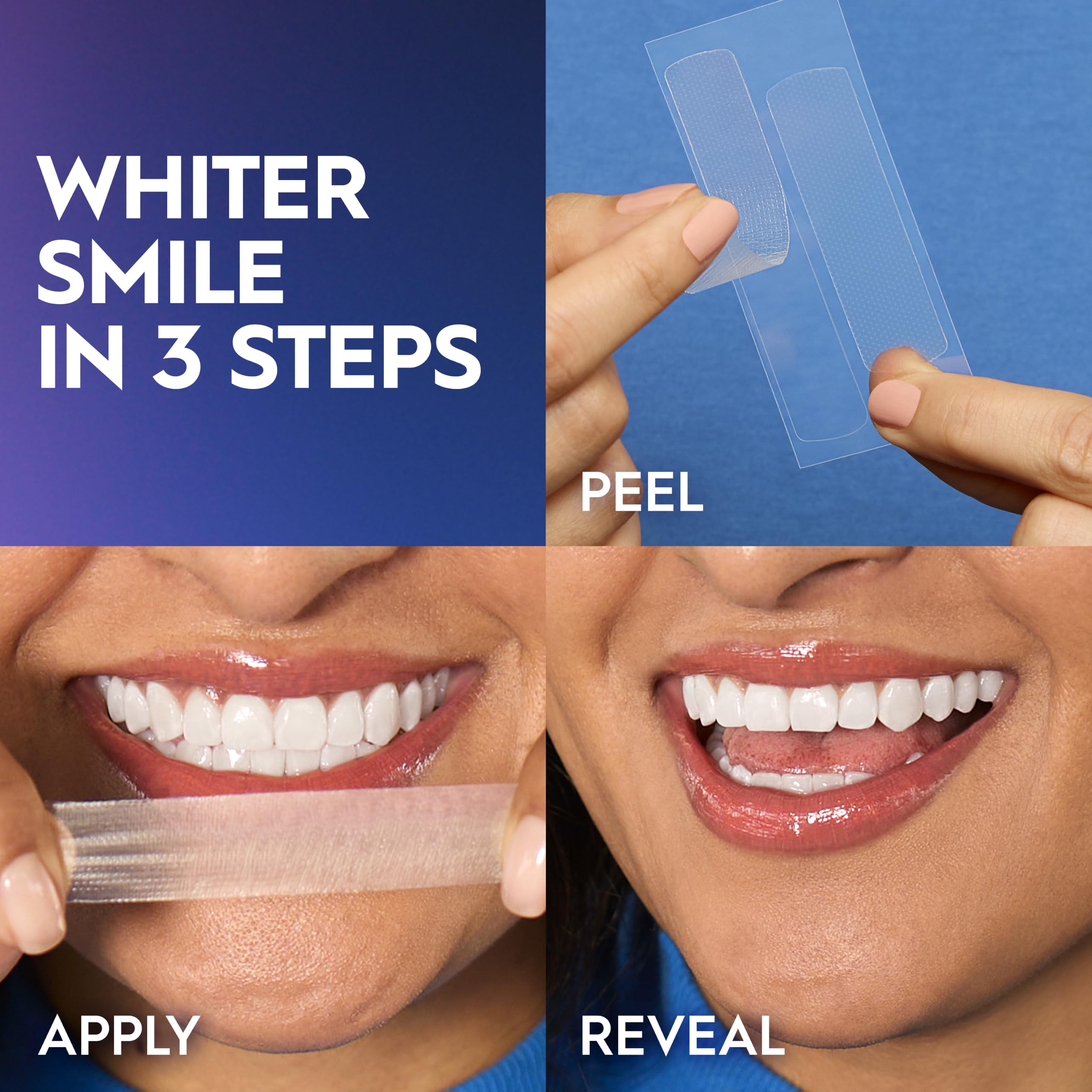 Crest usuario sonriendo tras tratamiento con mejora estética