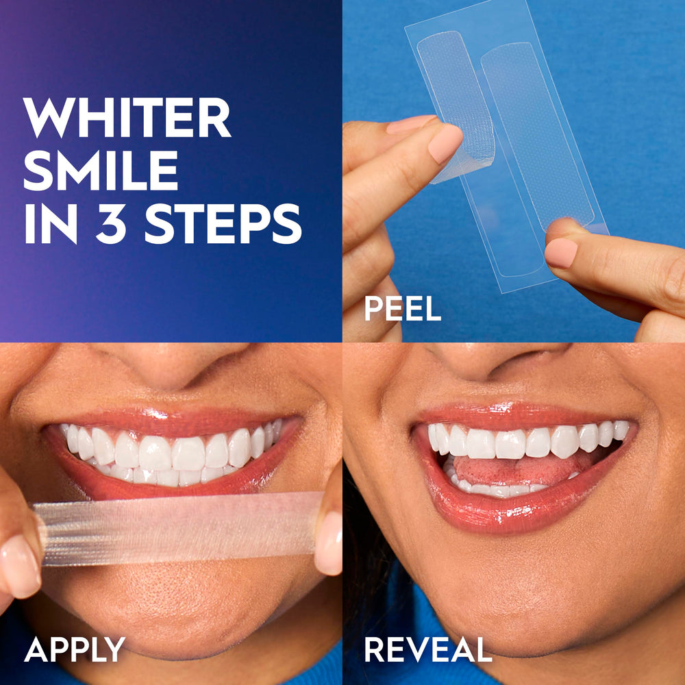Crest usuario sonriendo tras tratamiento con mejora estética