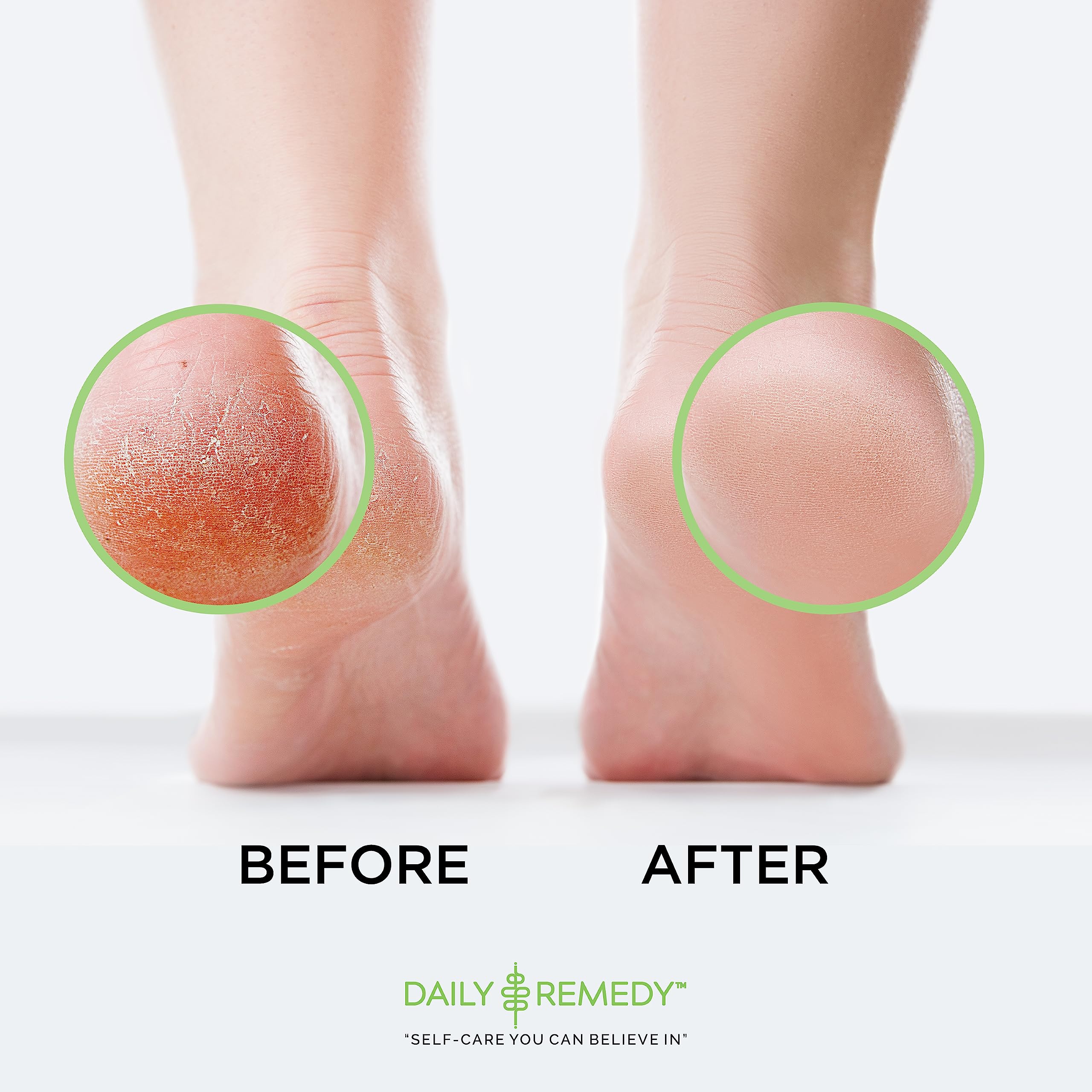 DAILY REMEDY comparación de tamaño 16 oz junto a objetos cotidianos, medida clara