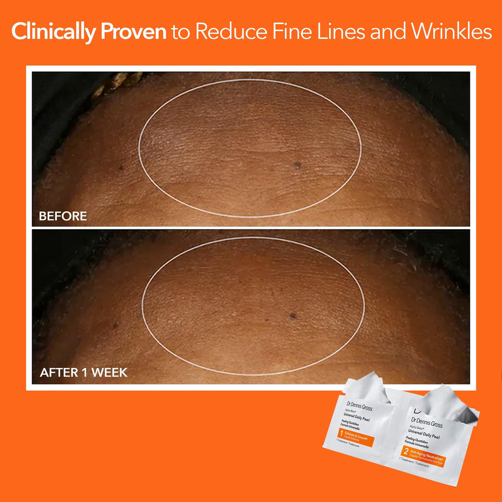 Dr Dennis Gross five‑pack box showing quantity and convenience for routine use
