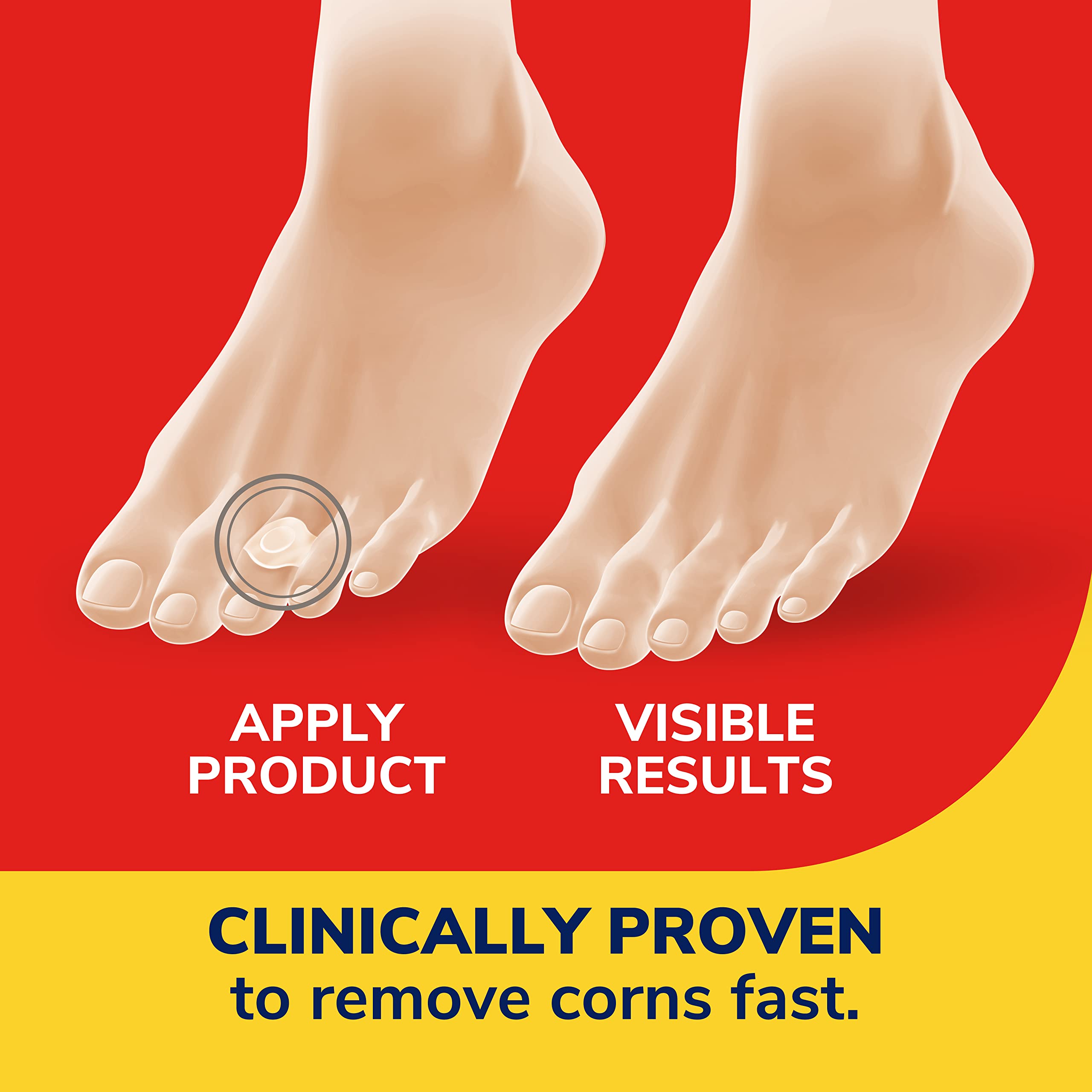 Dr. Scholl's parche aplicado en el pie para alivio y confort al caminar