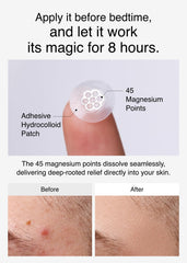 DWEasyDerm pinzas aplicadoras cerca, colocación higiénica y precisa