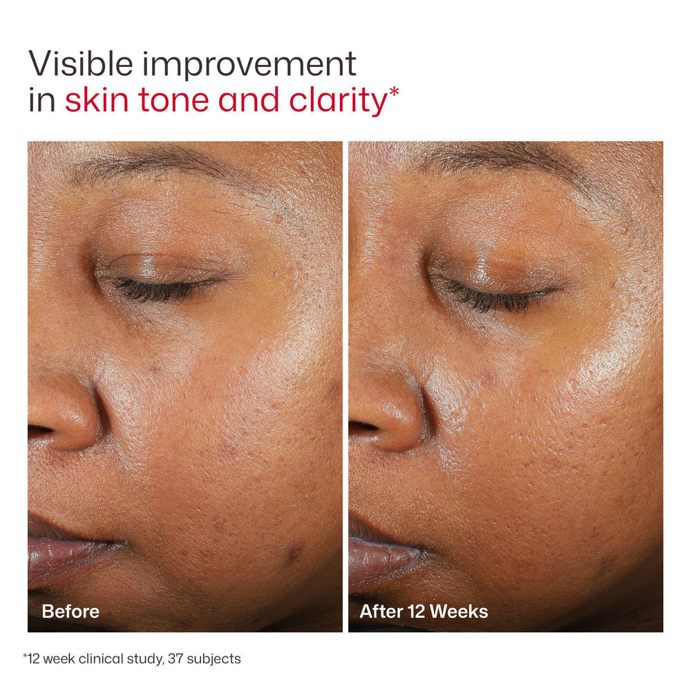 EltaMD etiqueta frontal con ingredientes y beneficios legibles