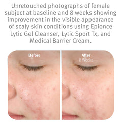 Espuma ligera de Epionce Lytic Gel en mano que disuelve maquillaje