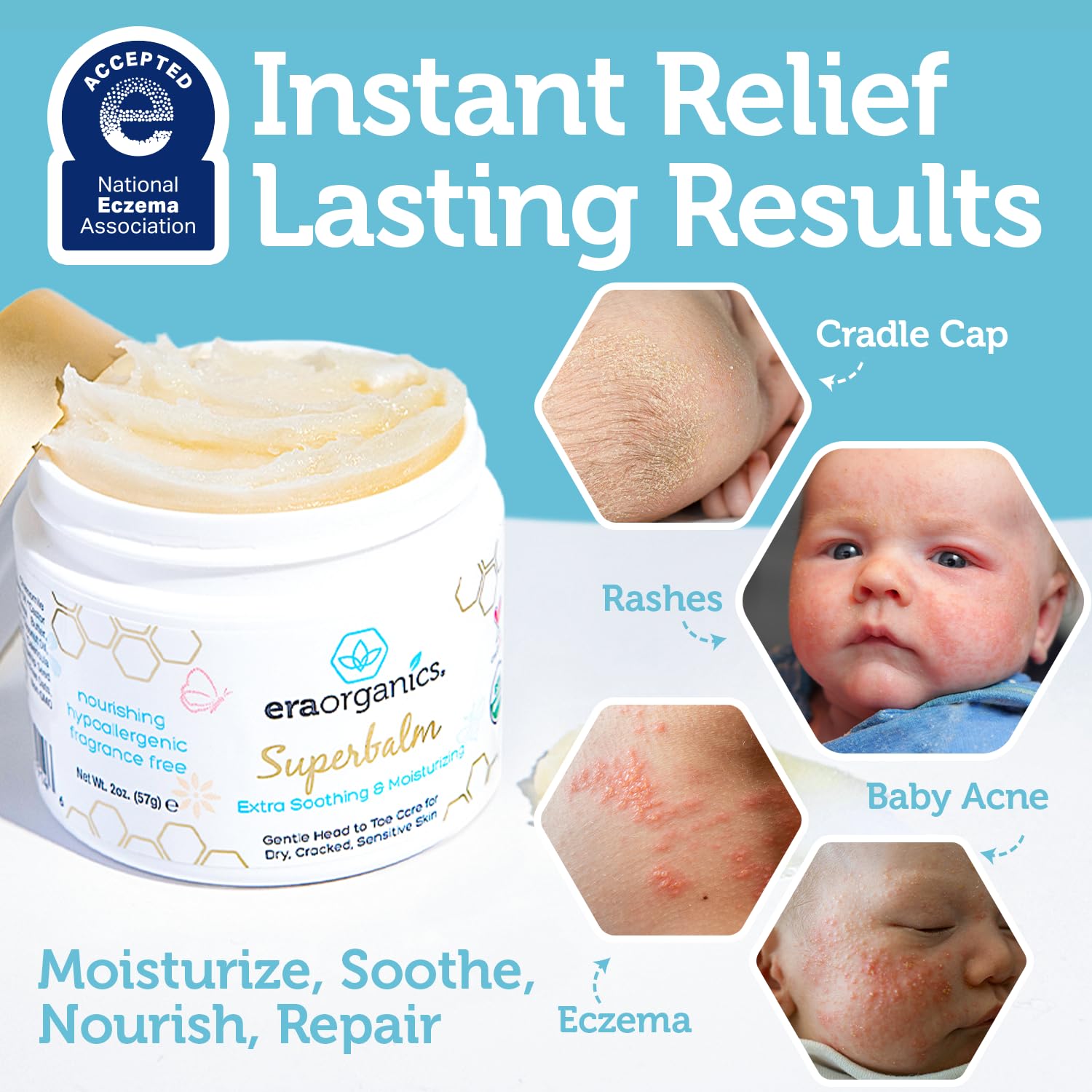 Era Organics aplicación del bálsamo en el cuello del bebé para aliviar