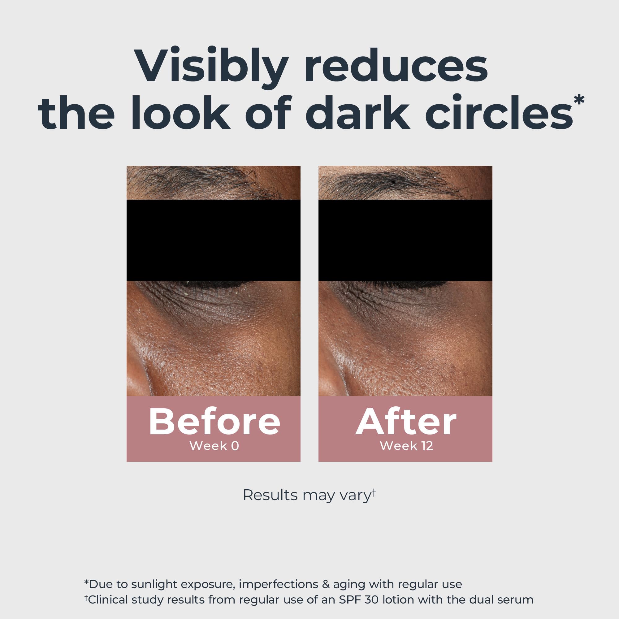 Eucerin aplicación en piel bajo ojo para reducir ojeras visualmente