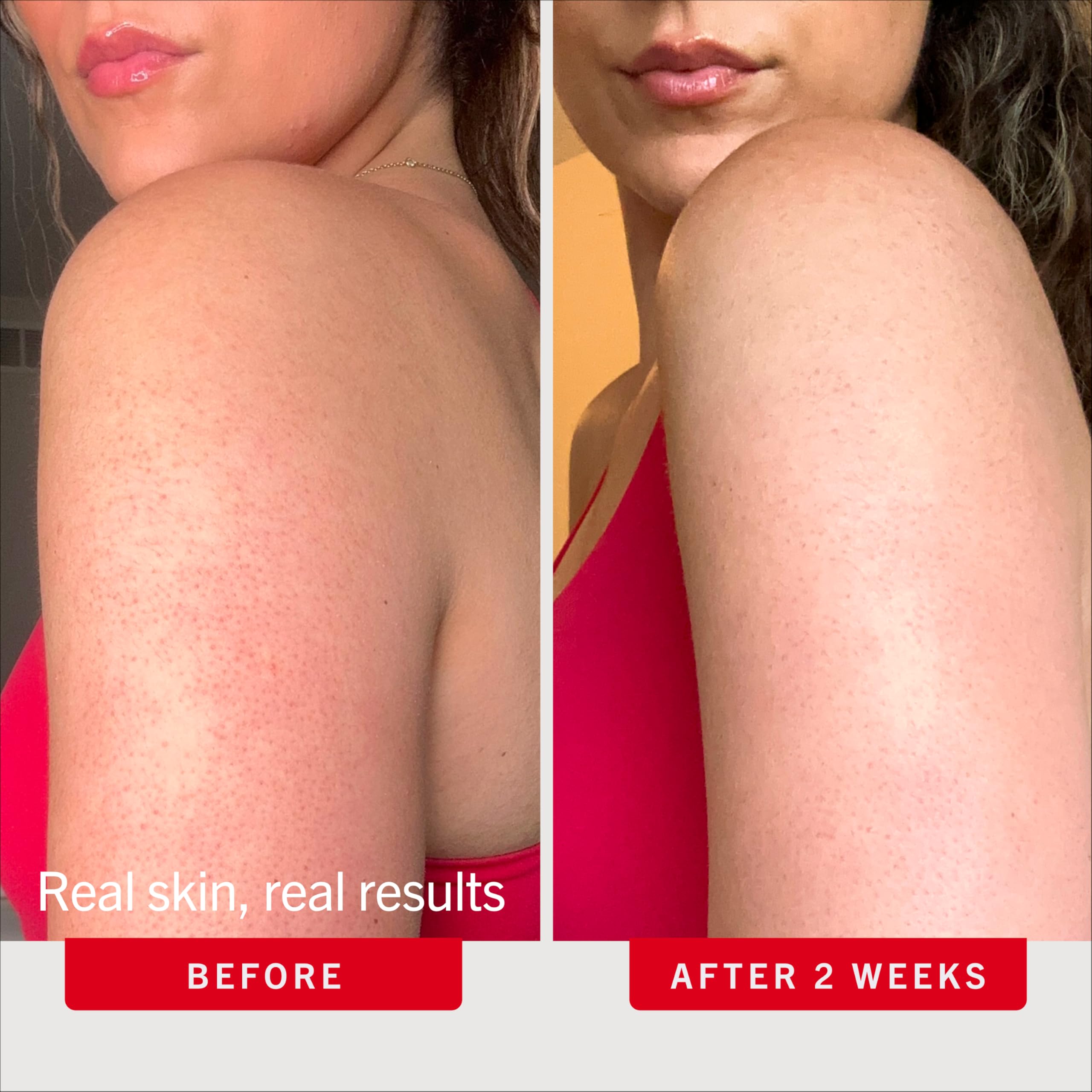 First Aid Beauty etiqueta con lista de ingredientes que destaca AHA y agentes calmantes