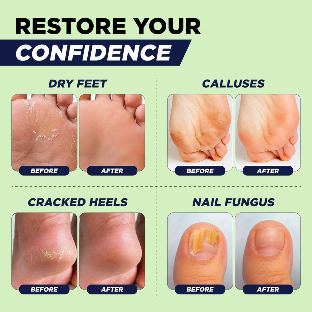FOOT CURE envase comparado con mano para apreciar tamaño y uso