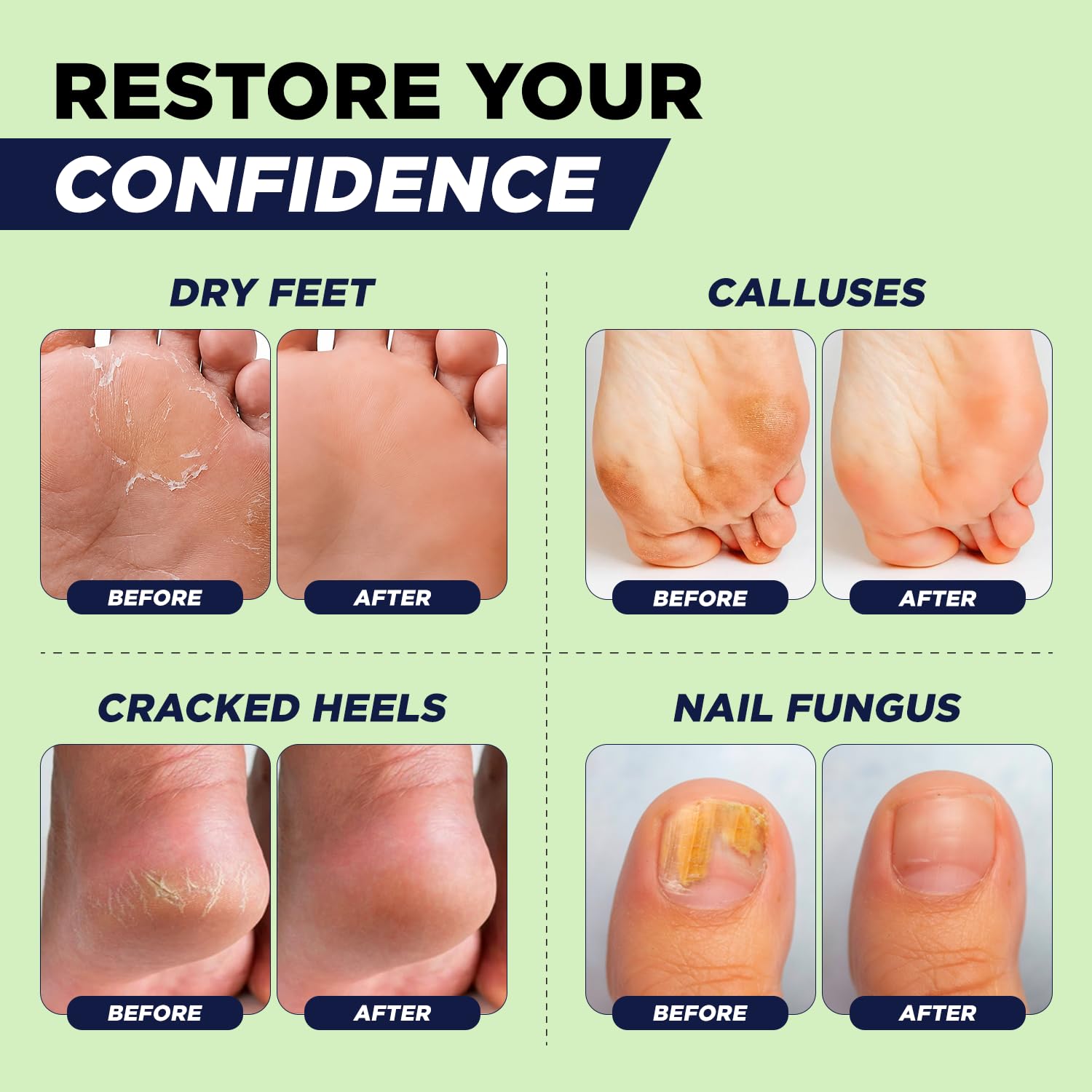 FOOT CURE cuenco con producto para comparar tamaño práctico