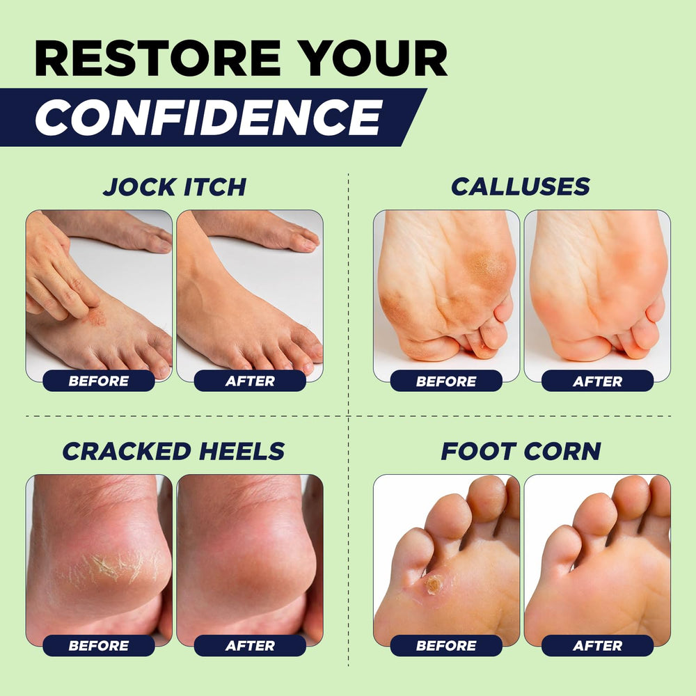 FOOT CURE pies y talones visiblemente más suaves tras uso regular