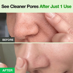 FULLY aplicación como mascarilla en rostro, desincrusta poros rápidamente