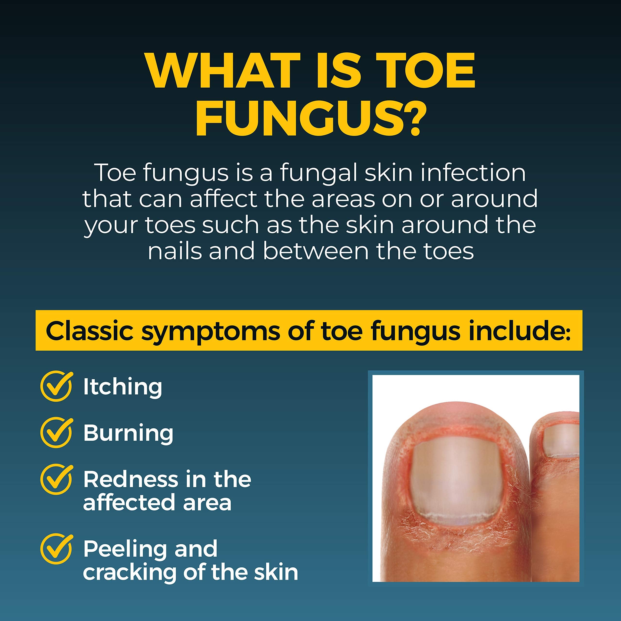 Fungi-Nail ingredientes naturales alineados indicando calmantes y humectantes