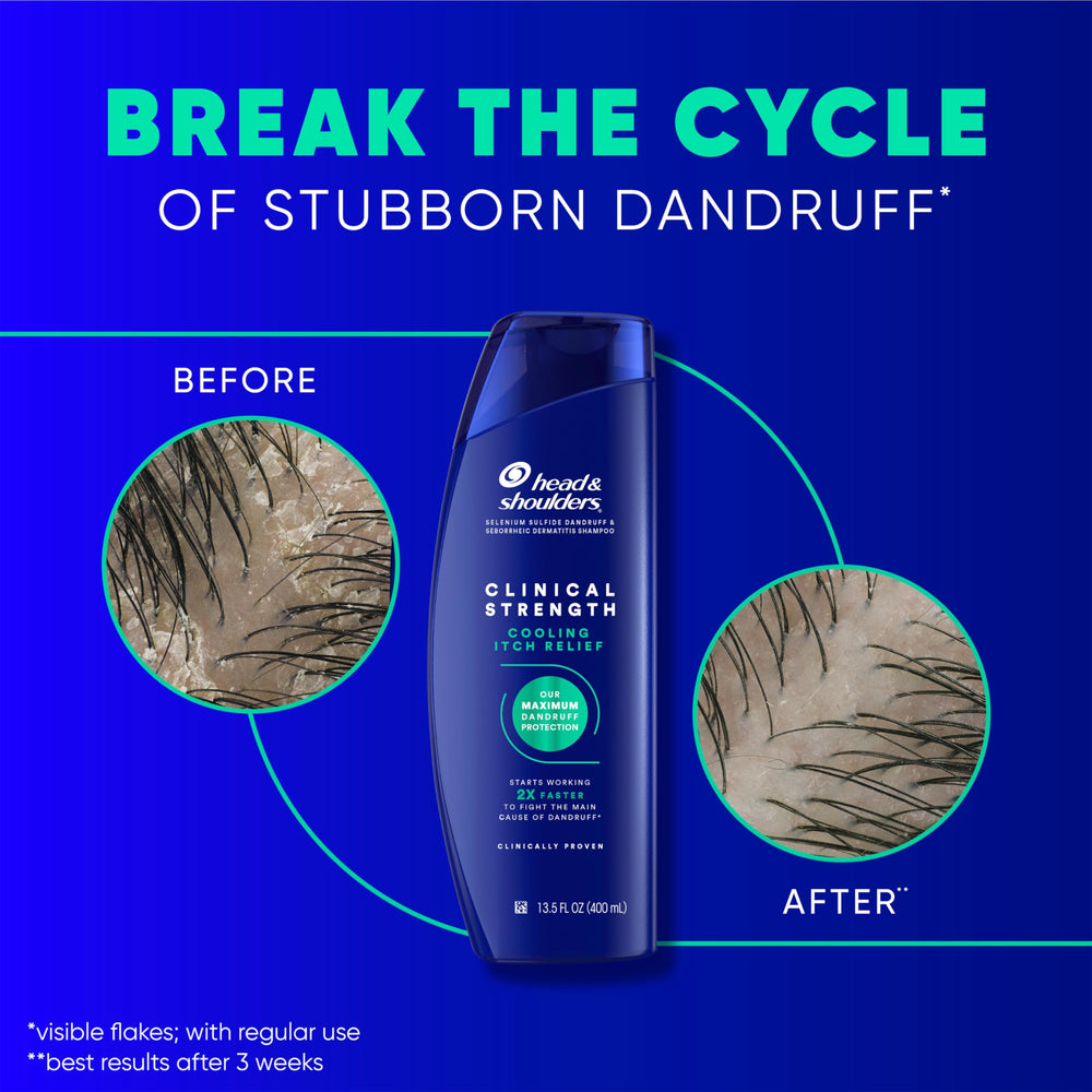 Head & Shoulders comparación de tamaño 13.5 fl oz para visualizar cantidad