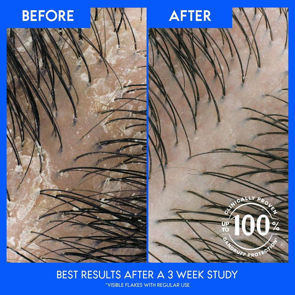 Head & Shoulders usada en ducha por mujer para mayor cuerpo visual