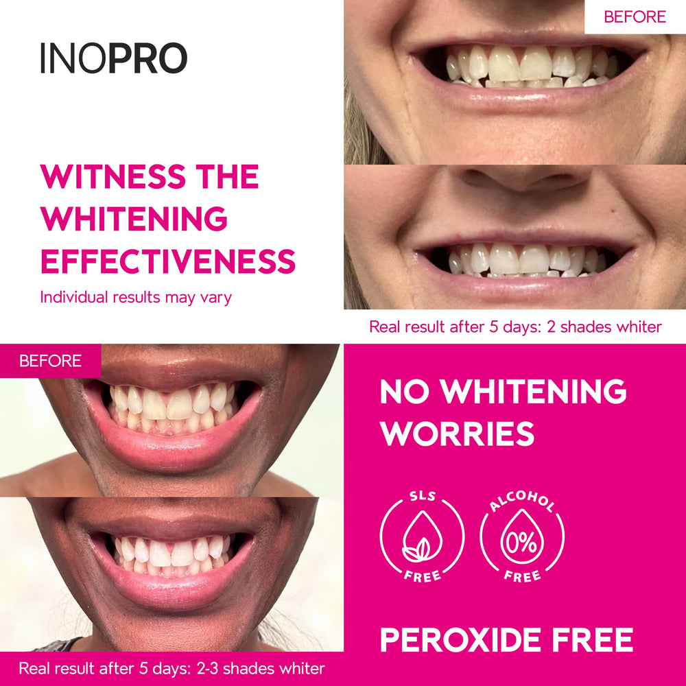 InoPro primer plano de la tira con gel, muestra textura suave