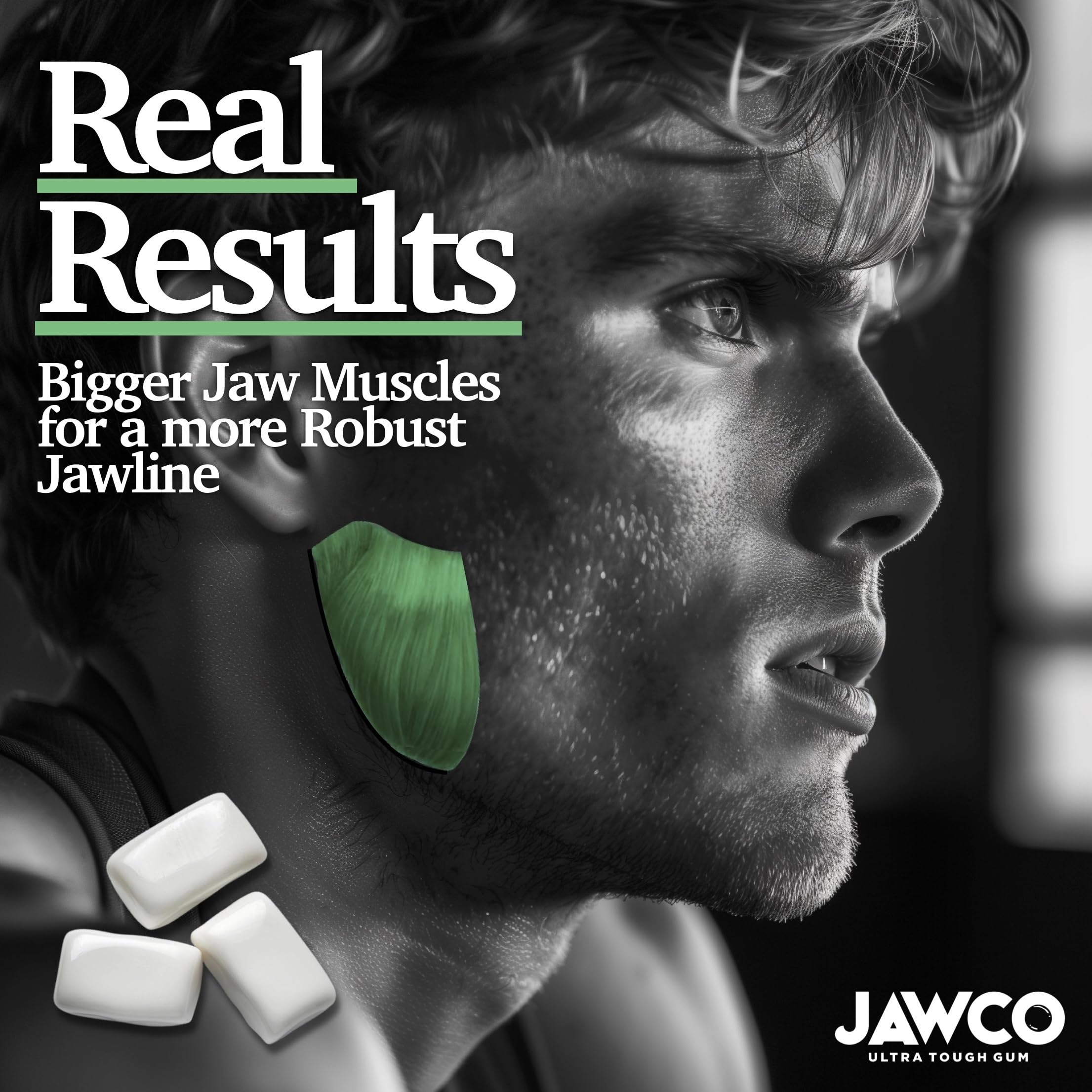 JAWCO en estilo de vida mostrando mayor definición del perfil mandibular