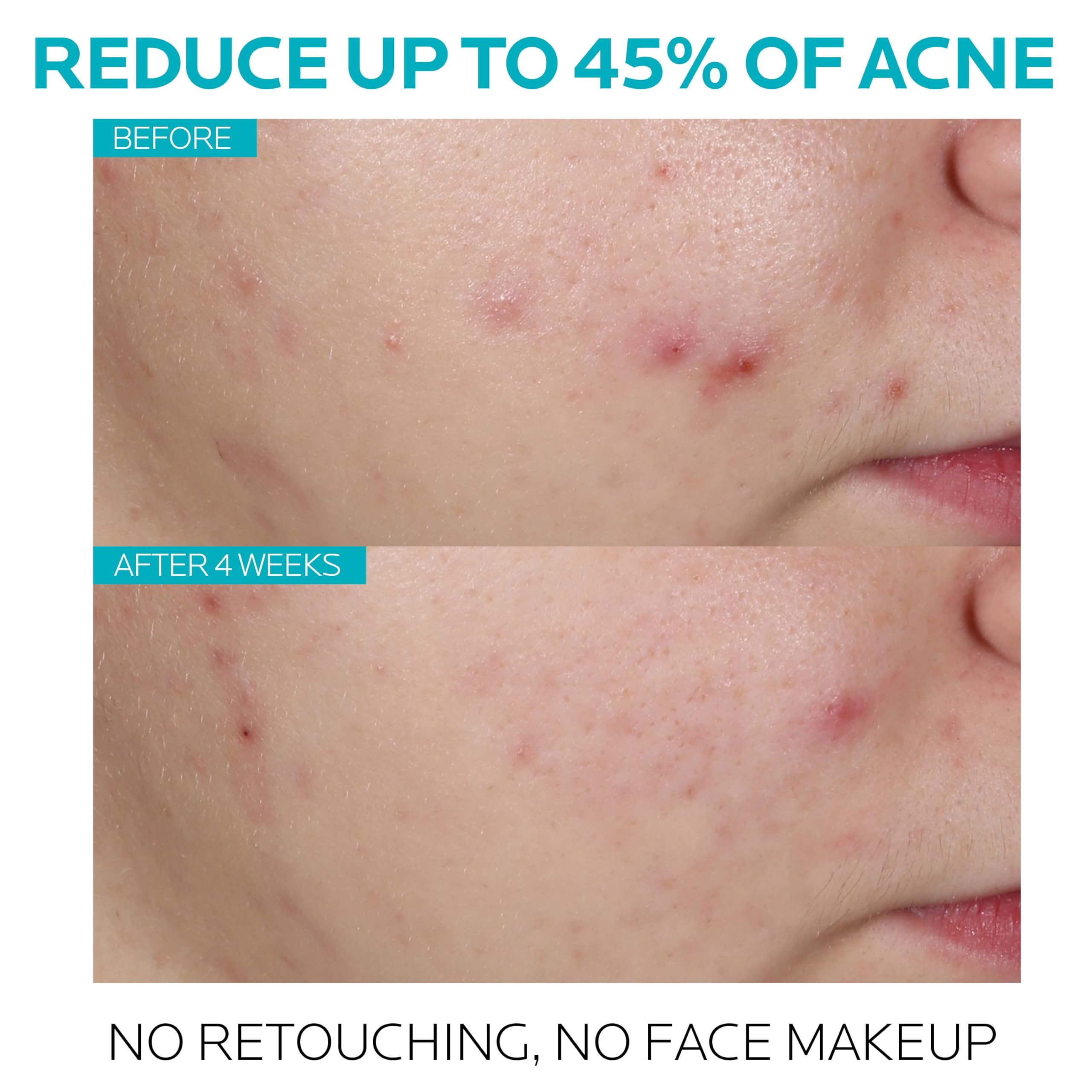 La Roche-Posay gotas del sérum destacando su textura ligera y rápida absorción