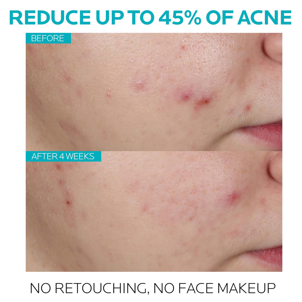 La Roche-Posay gotas del sérum destacando su textura ligera y rápida absorción
