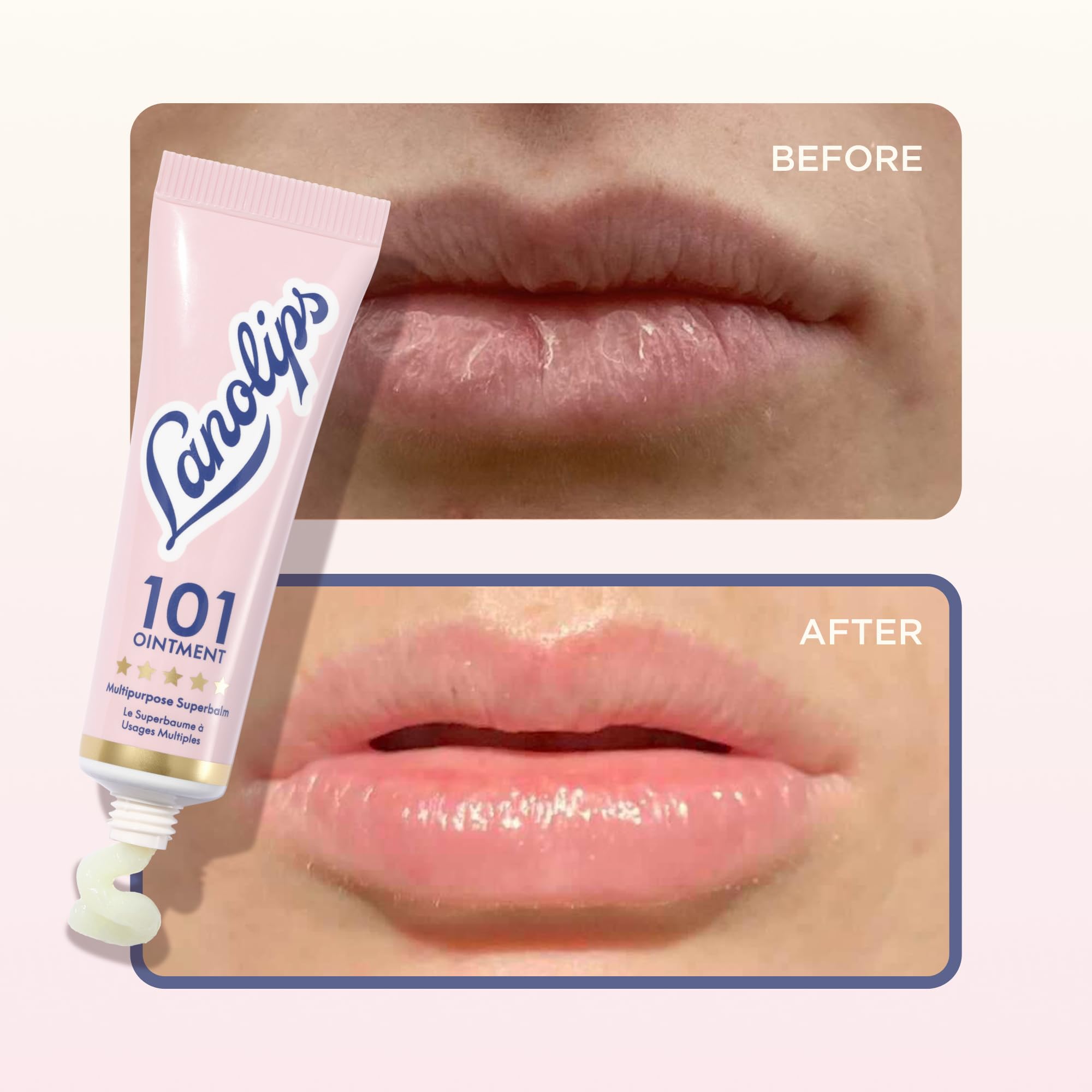 Lanolips aplicación en codo reseco mostrando mejora de textura