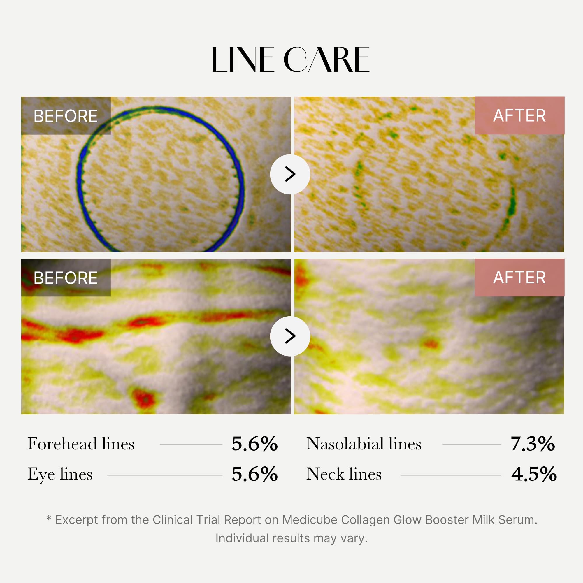 medicube comparación de tamaño para visualizar rendimiento