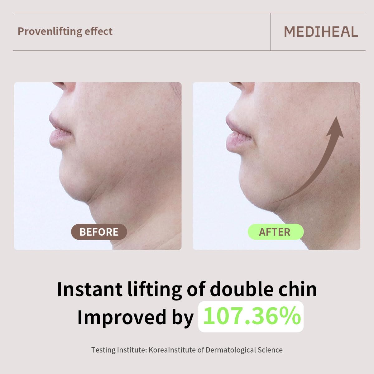 MEDIHEAL etiqueta con ingredientes clave visible, claridad informativa