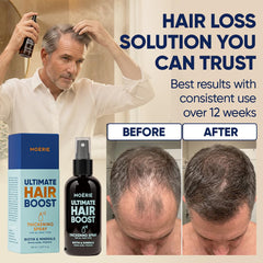 Moerie aplicación en cuero cabelludo de mujer para cabello fino