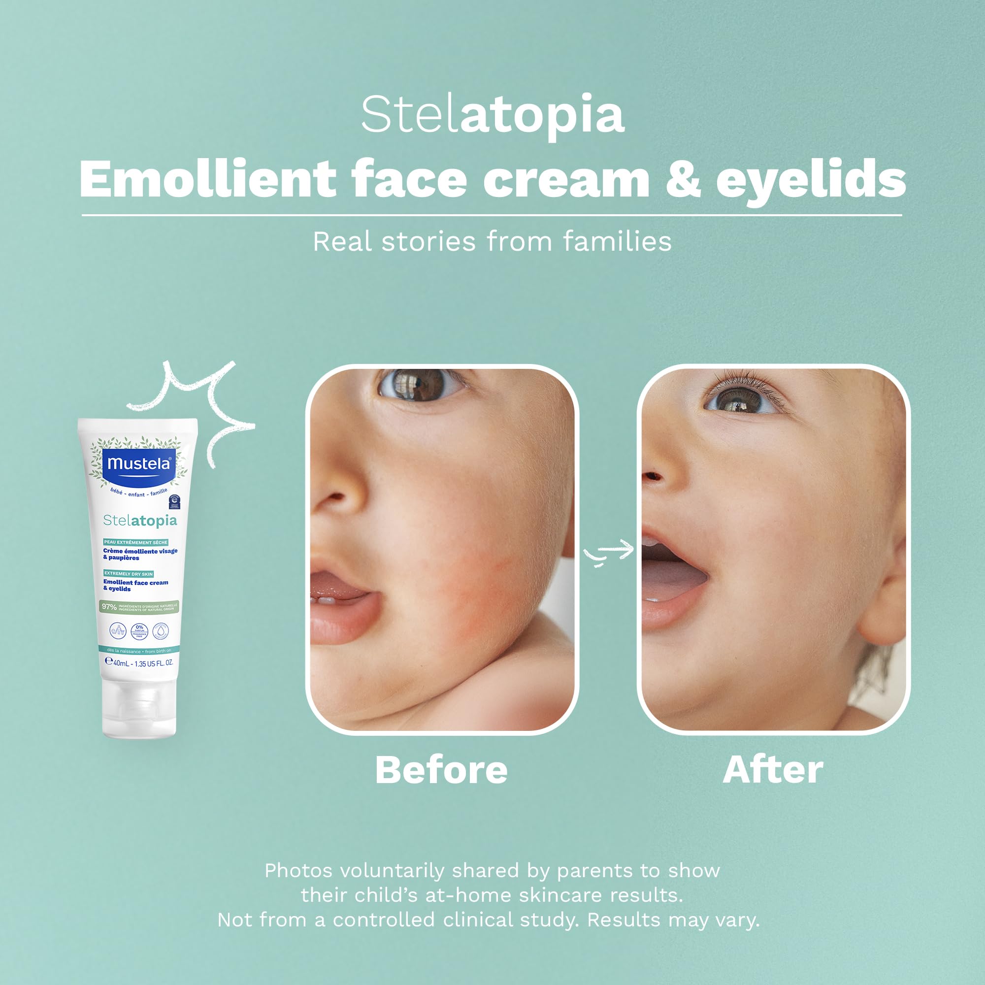 Mustela aplicación en bebé rostro para aliviar picor y enrojecimiento